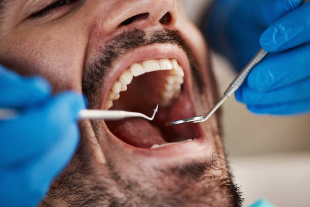 Best Weekend Emergency Dentist in Westerville, OH