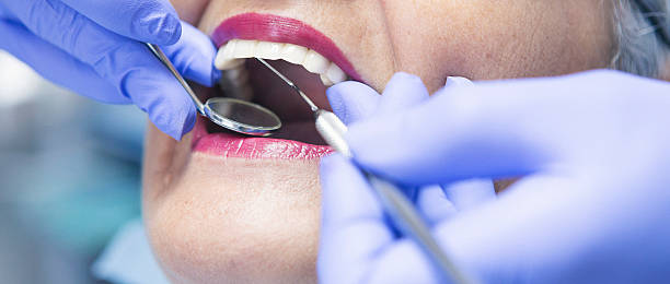 Best Emergency Root Canal Treatment in Westerville, OH